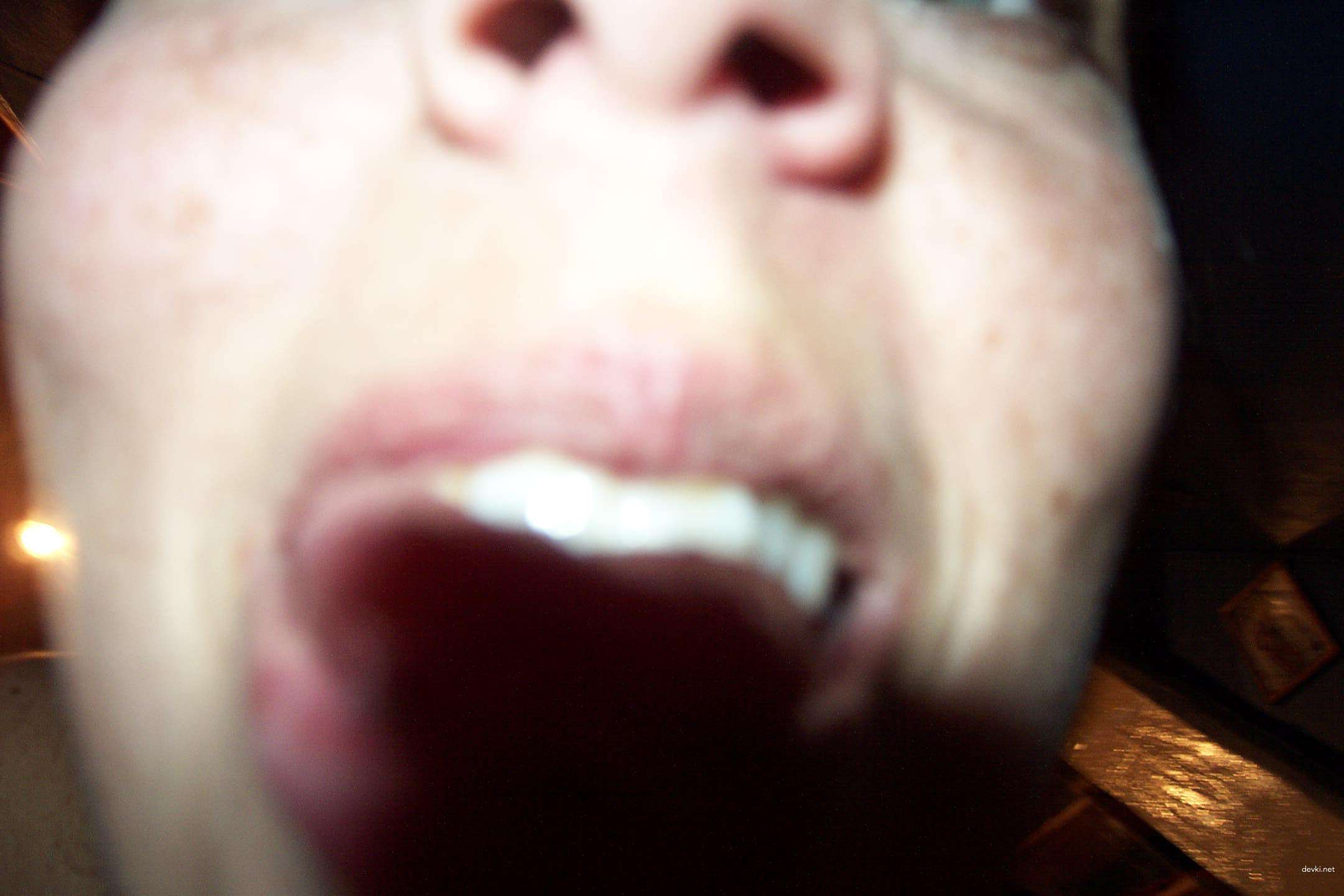 Uncensored Freckled Girl's Private XXX Collection - Explicit Amateur Porn Pics