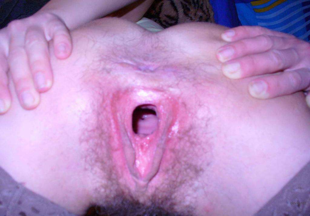 Raw Amateur Wife Gaping Holes Porn Pics