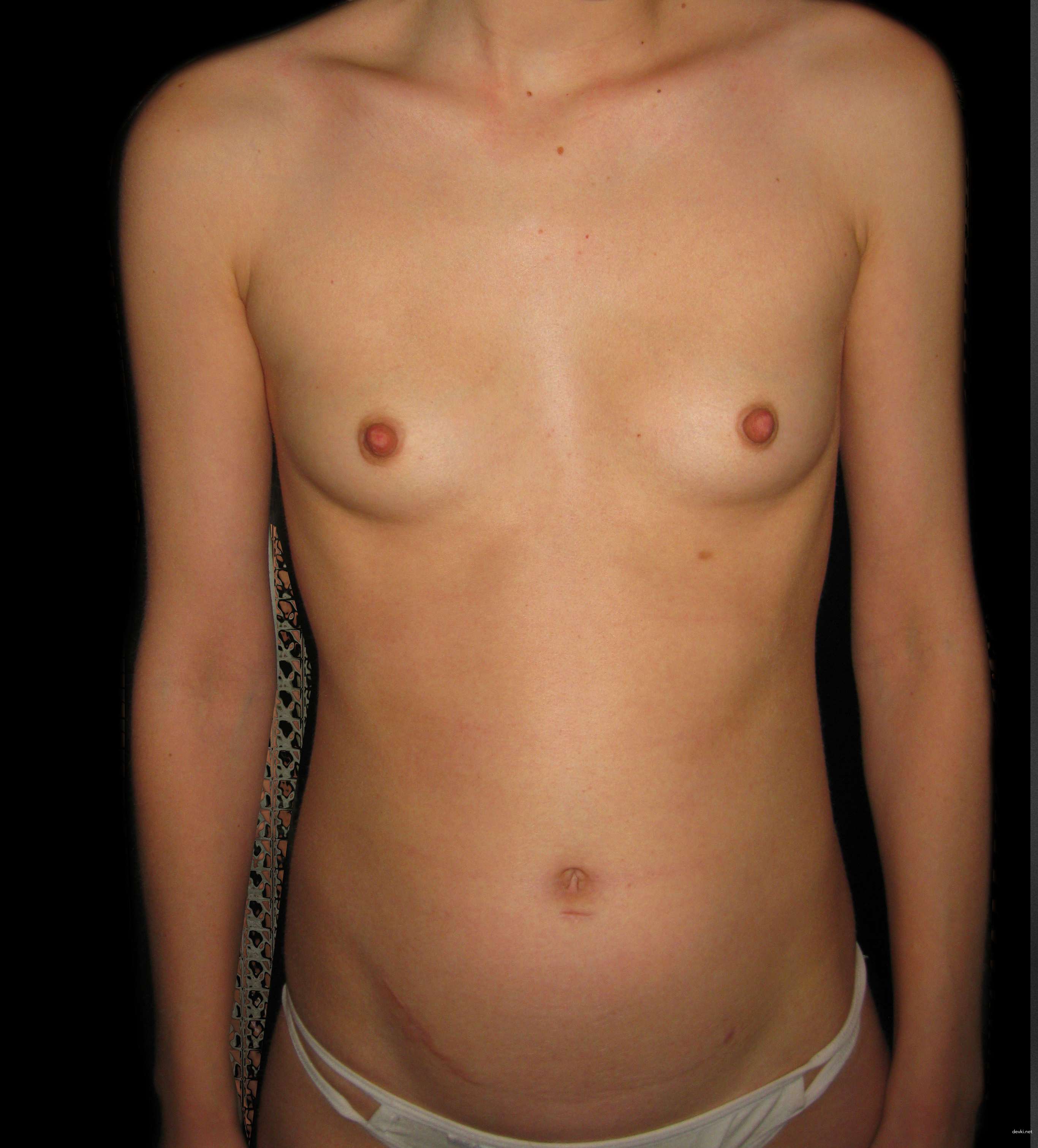 Tiny Tits and Perky Nipples Amateur Babe Exposed in XXX Photo